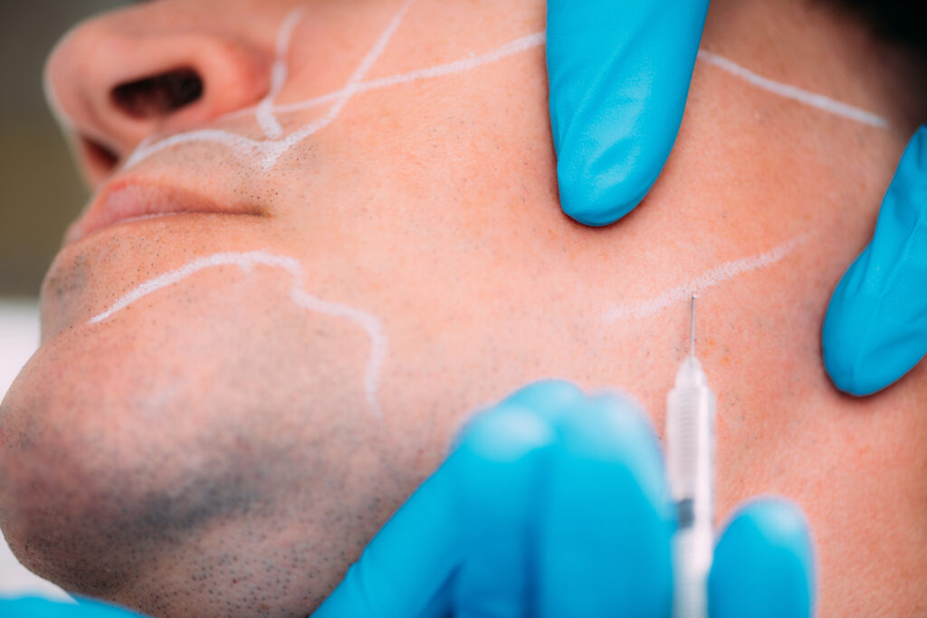 Dermal fillers 